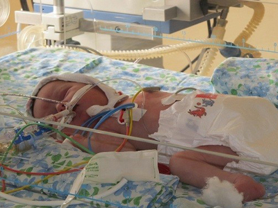 Малышку, которую спасли из выгребной ямы, врачи назвали Надеждой