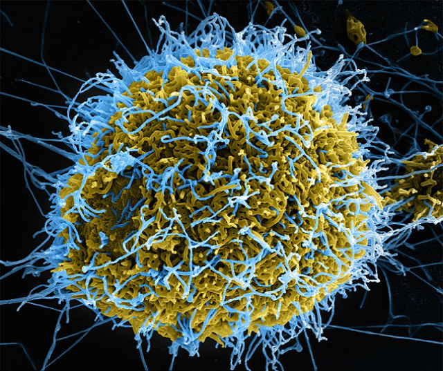 Изображение, полученное сканирующем электронным микроскопом и раскрашенное с помощью цифровых технологий. Голубым цветом отмечены нитевидные частицы вируса Эбола (иллюстрация Centers for Disease Control and Prevention). 