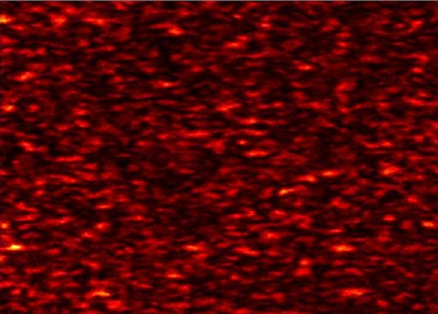 Спекл яблока сорта Голден (фото Rana Nassif/Université de Bretagne Occidentale de Brest).