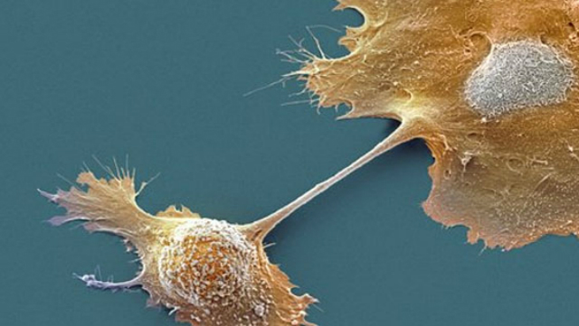 Электронная микроскопия клеток поджелудочной железы (фото Sanford-Burnham Medical Research Institute).