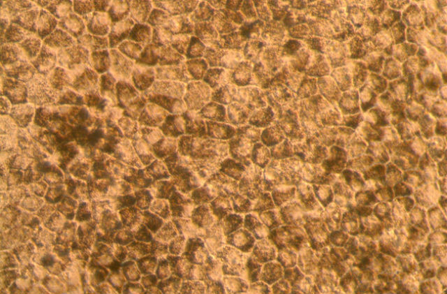 Клетки сетчатки, полученные из эмбриональных стволовых клеток (фото Ocata Therapeutics).
