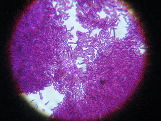 Секрет механизма защиты от аллергии заключался в попадании в организм лактобациллы вида Lactobacillus johnsonii (фото Shoko Muraguchi/Flickr.com).