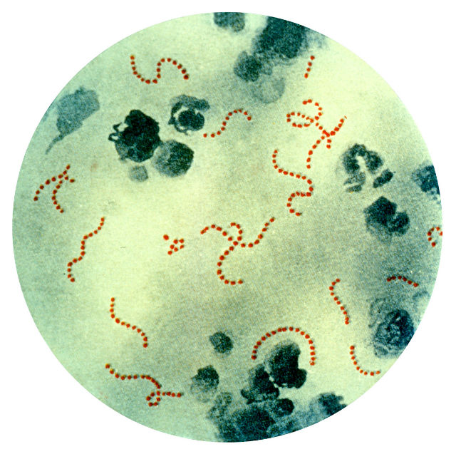 Бактерия вида Streptococcus pyogenes (фото CDC). 