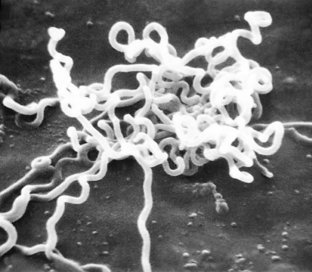 Бледная трепонема считается возбудителем различных заболеваний, в том числе и сифилиса у западного человека, однако у хадза эти бактерии многочисленны и не доставляют им проблем (фото Wikimedia Commons). 