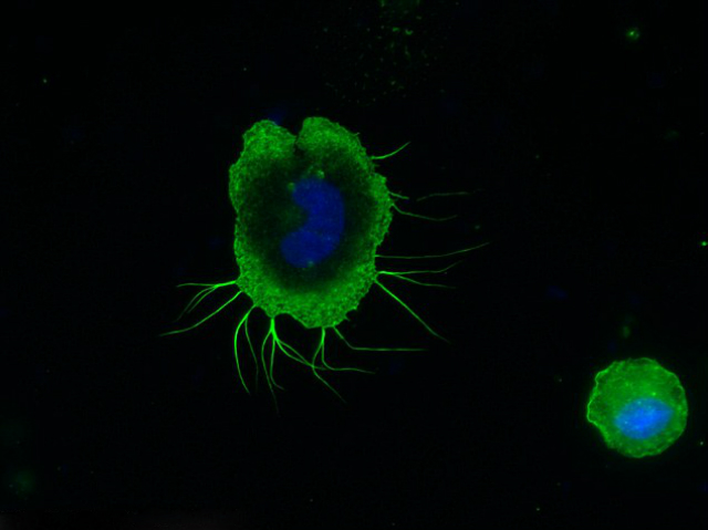 В ходе эксперимент CellBox Mission будет выяснено, как клетки человеческой иммунной системы (фагоциты) реагируют на микрогравитацию (фото Svantje Tauber, Anatomisches Institute). 