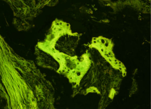 Костная ткань, сформированная из ИПК у макаки-резуса 