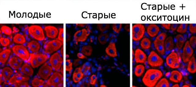 Сравнение мышечных тканей у молодых и старых мышей, а также у тех, кому ввели инъекции окситоцина (иллюстрация Wendy Cousin, Christian Elabd, UC Berkeley). 