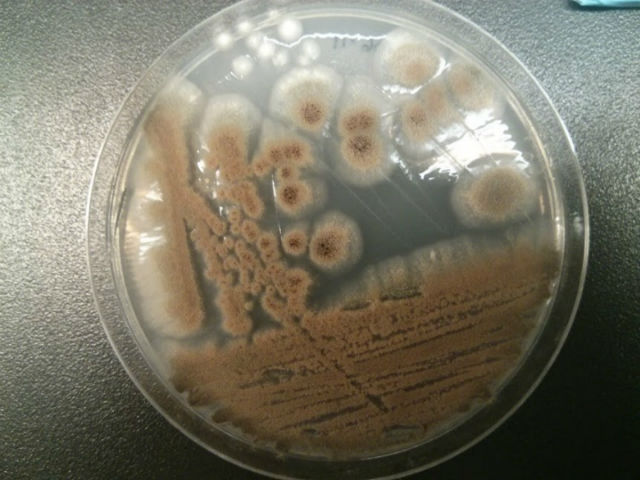 Для проведения экспериментов учёные выделили молекулу АМА из грибка вида Aspergillus versicolor (фото McMaster University). 