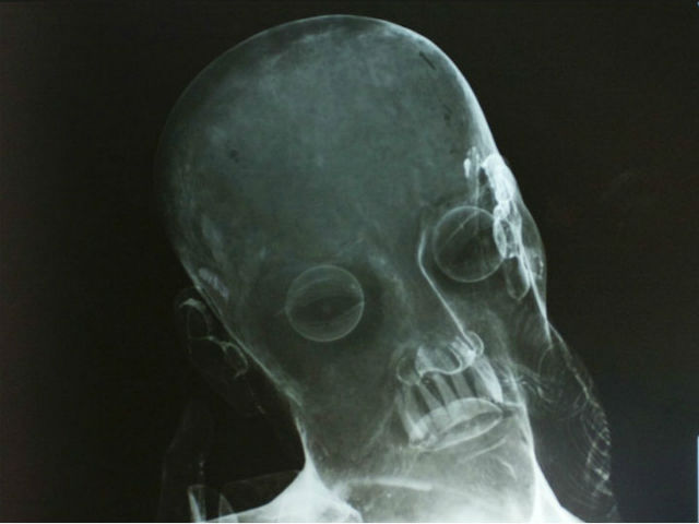 Рентген статуи Христа обнаружил внутри настоящие человеческие зубы (кадр YouTube, INAH TV). 
